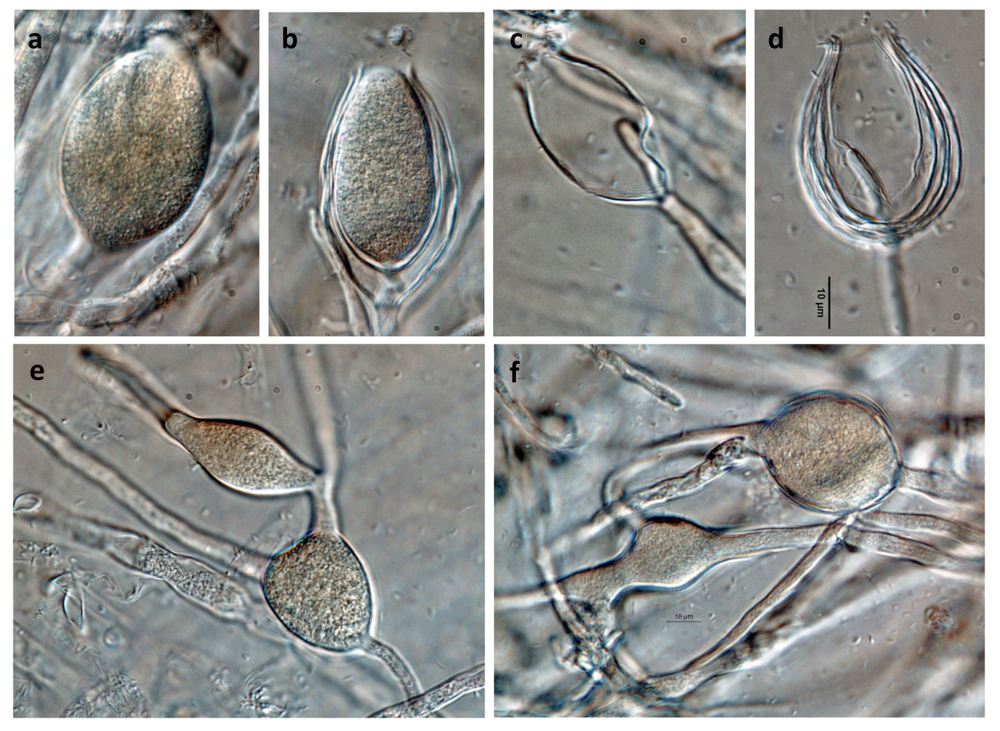   Phytophthora inundata  (CPHST BL 20, selected specimen) asexual phase: (a, b) nonpapillate persistent sporangia; (bndash;d) with internal proliferation; (endash;f) different shapes of hyphal swellings; photos by Gloria Abad, USDA-APHIS-PPQ. 
